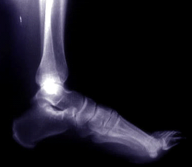 X-ray of 
